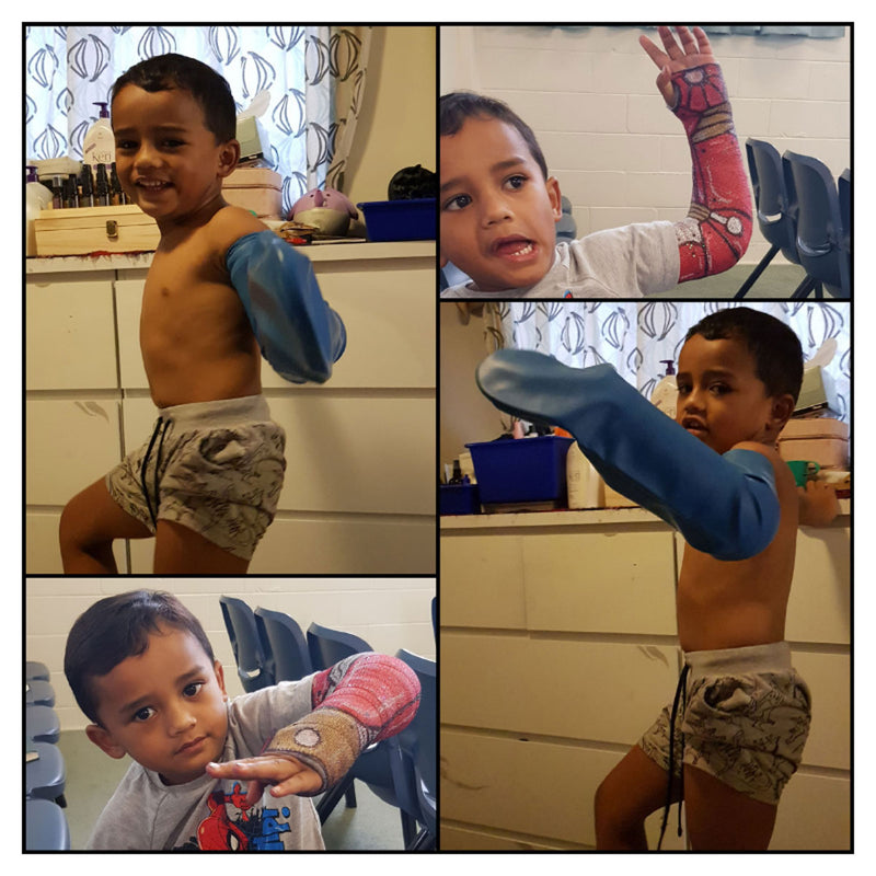 Montage of poses with a full arm waterproof cast protector