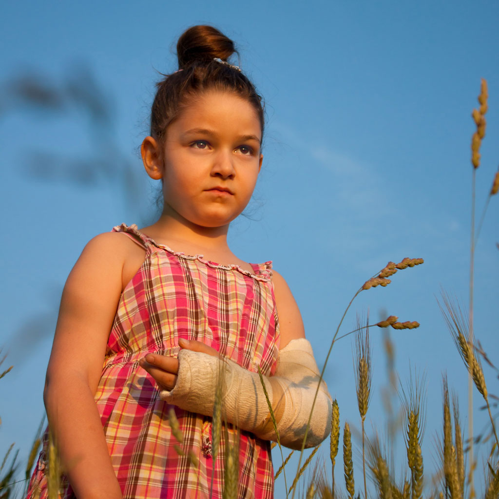 Young girl with a broken arm standing in a field