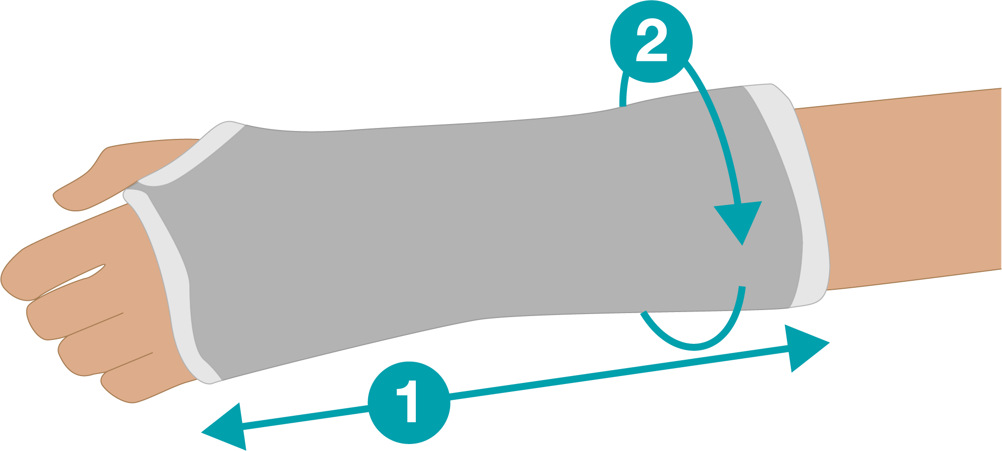 Decorative Arm Cast Covers